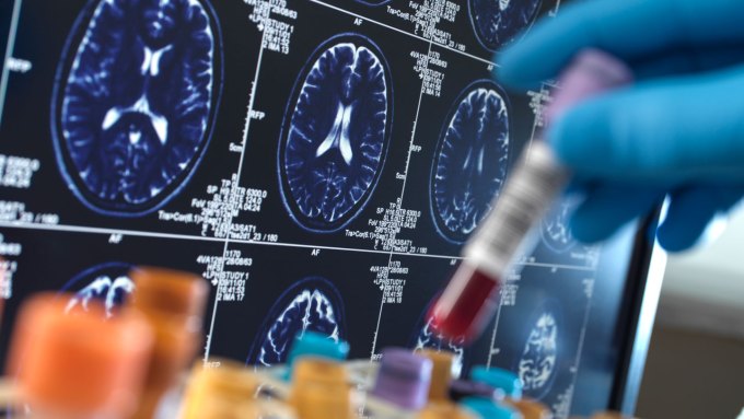 A vial of blood is put into a tube rack, with medical images of a brain in the background.