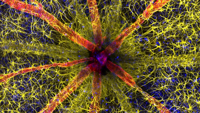 An image of the back of a rat's eye seen at 20 times magnification with immune cells seen in yellow and blood vessels seen in red.